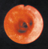 Image of an inflamed lung airway